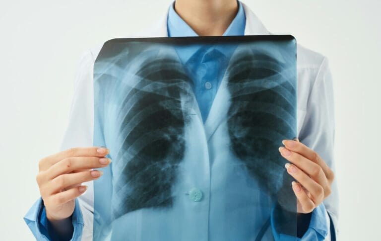Un doctor care tine in maini rezultatele unei radiografii