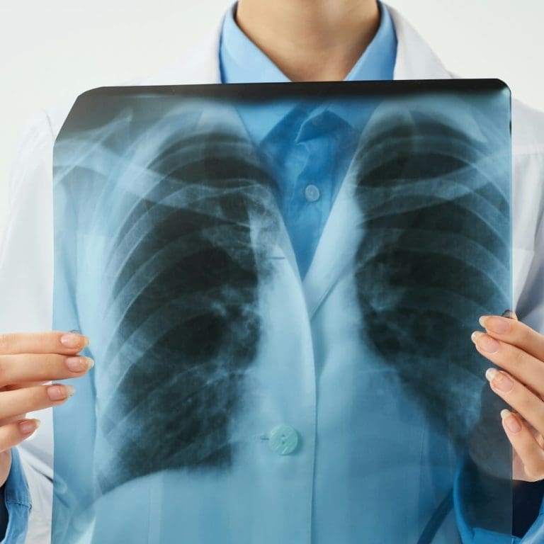 Un doctor care tine in maini rezultatele unei radiografii